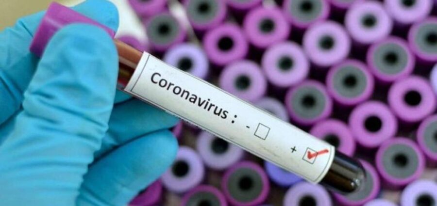 Resultado de imagen de coronavirus positivo